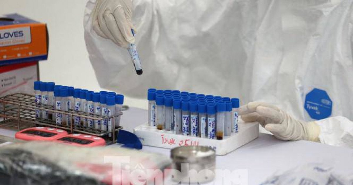 Số ca nhiễm COVID-19 ở Việt Nam không tăng theo quy luật của thế giới