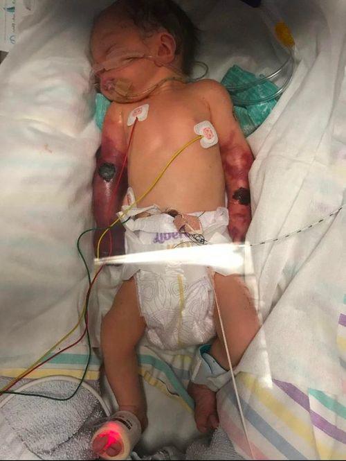 Con vừa chào đời 2 tay tím đen, nghe bác sĩ nói nguyên nhân bố mẹ không tin nổi - 2