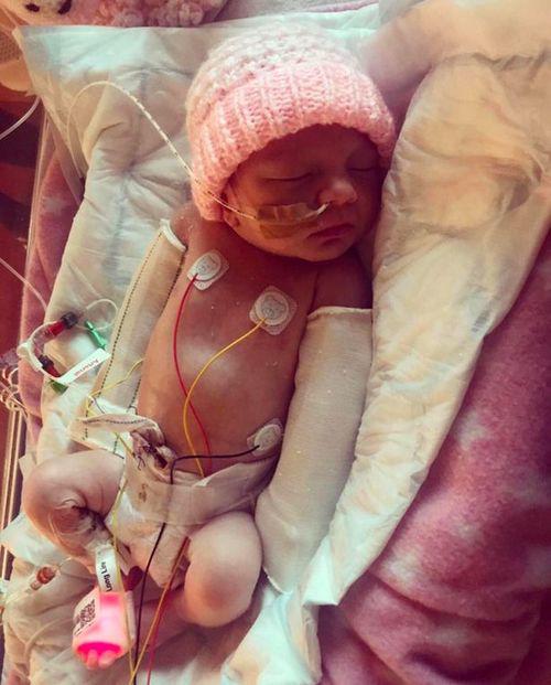 Con vừa chào đời 2 tay tím đen, nghe bác sĩ nói nguyên nhân bố mẹ không tin nổi - 3