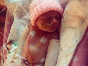 Bà bầu - Con vừa chào đời 2 tay tím đen, nghe bác sĩ nói nguyên nhân bố mẹ không tin nổi