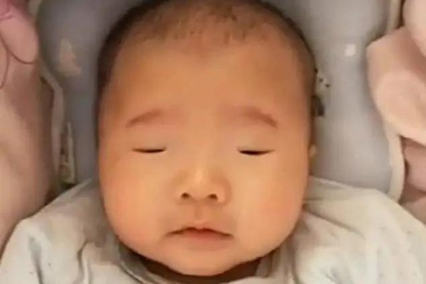Sau sinh 9 ngày mắt con vẫn không mở, mẹ sợ hãi đi khám nhưng bác sĩ lại bật cười - 1