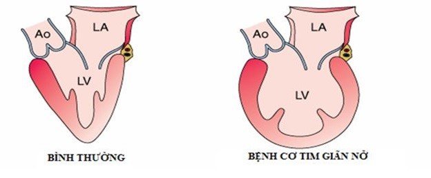 Dấu hiệu bệnh tim thường gặp cần lưu ý - 6