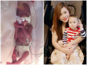Làm mẹ - Mẹ Việt ở Mỹ sinh non 5 tháng nặng 6 lạng, con 2,5 tuổi không ai nhận ra