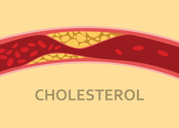Thực phẩm nào nhiều cholesterol và cách giảm cholesterol hiệu quả - 1