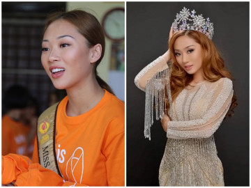 Căn bệnh khiến Hoa hậu Việt Nam Toàn cầu qua đời ở tuổi 22 người trẻ dễ mắc phải