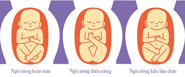 4 vị trí nằm của thai nhi trong bụng mẹ, tư thế đầu tiên là tốt nhất - 7
