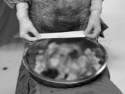 Sức khỏe - Người phụ nữ mọc 80 khối u xơ tử cung, bác sĩ phụ khoa khuyên đừng mắc sai lầm này