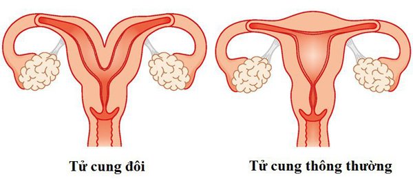 me de xong gan thang van thay bung "dong day", bac si bang hoang phat hien con sot 2 be - 3