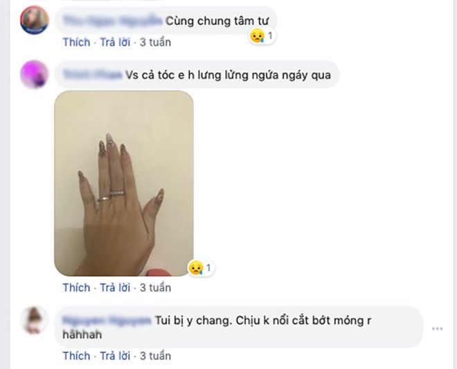 day la nhung dich vu “gay thuong nho” nhat doi voi chi em, chi cho het dich la len duong - 4