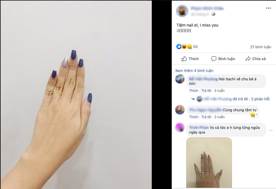 day la nhung dich vu “gay thuong nho” nhat doi voi chi em, chi cho het dich la len duong - 3