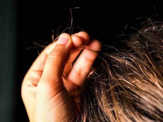 Hà Nội: Con gái ăn tóc suốt 9 năm bố mẹ không biết, hậu quả khiến tất cả ngỡ ngàng
