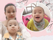 Làm mẹ - Cãi lời bác sĩ giữ con, mẹ Lâm Đồng nhọc nhằn "may môi" cho con trai bị dị tật