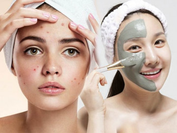 Trả lời được những câu hỏi này, nàng sẽ biết ngay loại mặt nạ trị mụn phù hợp với mình