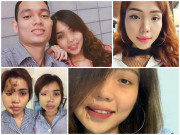 Tin tức - Sau hơn 1 năm, cô gái bị chồng sắp cưới là thiếu úy công an tạt axit giờ ra sao?