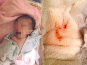 Làm mẹ - Mẹ cứu con gái 1 tuổi thoát chết nhờ phát hiện sớm vệt máu dính ở tã