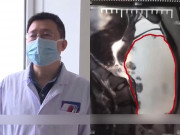 Tin tức - Nghi con gái mang thai vì bụng cứ lớn dần, bố mẹ đưa đi khám mới biết sự thật sốc