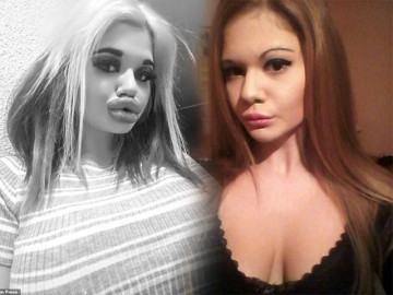 Bơm môi dày như cặp xúc xích chập đôi, tiêu chuẩn đẹp của một số cô gái sao lạ quá!