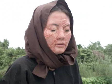 "Rổ sạn" Luật Trời: Lan Ngọc bị tạt axit vẫn tiếc bộ lông mi, giày thể thao "đi lạc"