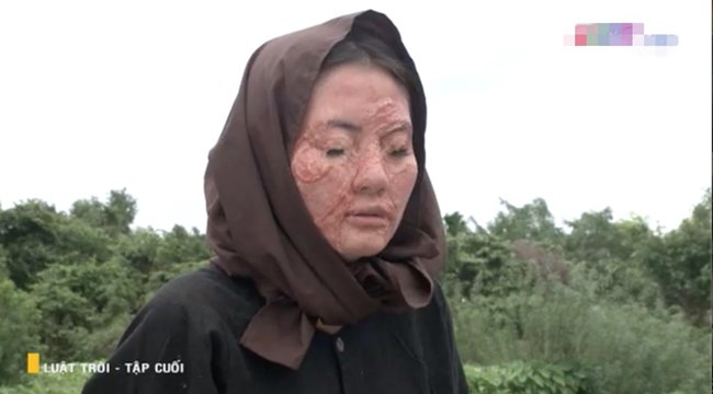 amp;#34;Rổ sạnamp;#34; Luật Trời: Lan Ngọc bị tạt axit vẫn tiếc bộ lông mi, giày thể thao amp;#34;đi lạcamp;#34; - 3