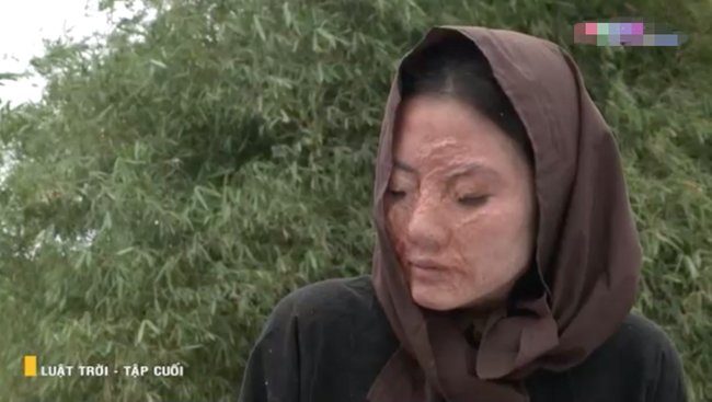 amp;#34;Rổ sạnamp;#34; Luật Trời: Lan Ngọc bị tạt axit vẫn tiếc bộ lông mi, giày thể thao amp;#34;đi lạcamp;#34; - 4