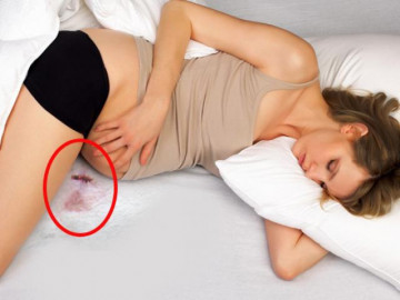 Ra máu như hành kinh khi mang thai nguy hiểm như thế nào?