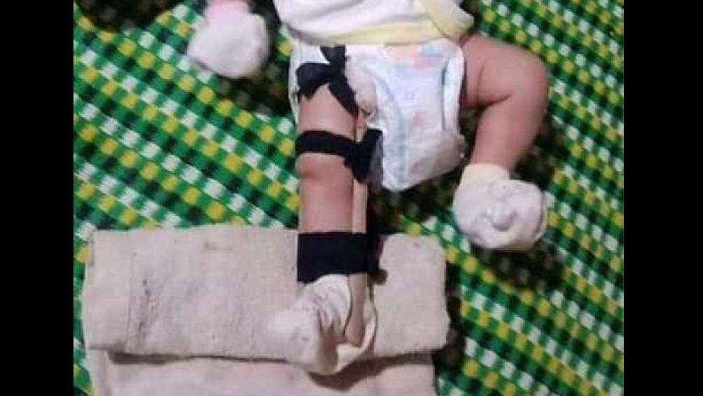 Phẫn nộ người cha bạo hành, đánh con 2 tháng tuổi gãy chân ở Bình Phước - 1