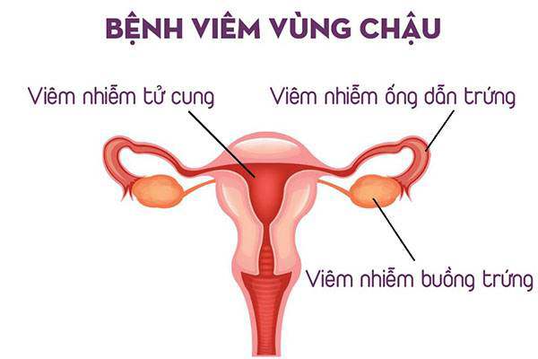 Khí hư màu vàng xanh cảnh báo bệnh gì? - 5