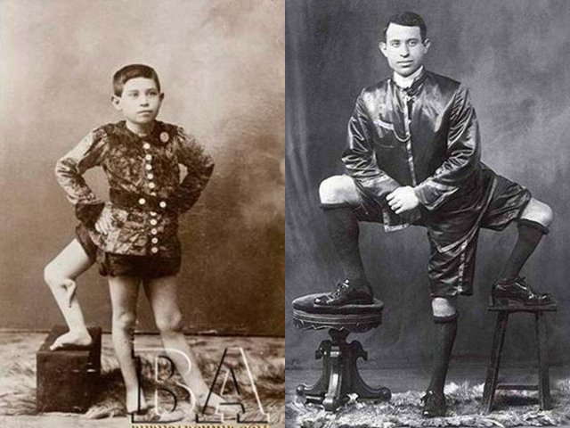 Cuộc đời dị nhân 3 chân và 2 của quý: Cả đời đi mua vui nhưng không giữ được vợ