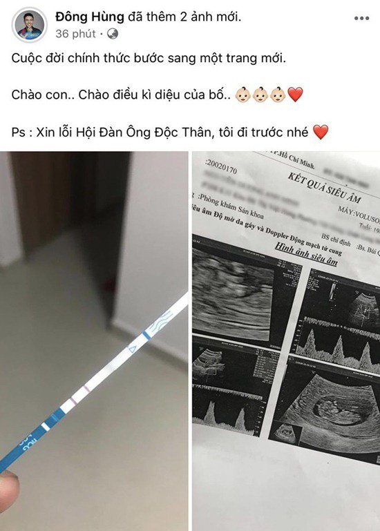 Sao Việt 24h: Sau khi bạn gái sinh năm 1999 có thai, ca sĩ Đông Hùng chính thức hỏi cưới - 5