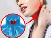 Sức khỏe - Tự kiểm tra bệnh tuyến giáp nhờ 1 cốc nước, làm ngay kẻo nhỡ ung thư để lâu khó chữa
