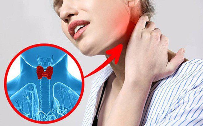 Tự kiểm tra bệnh tuyến giáp nhờ 1 cốc nước, làm ngay kẻo nhỡ ung thư để lâu  khó chữa
