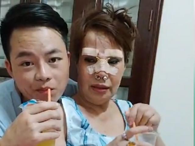 Tin tức 24h: Cô dâu Thu Sao tân trang nhan sắc ở tuổi 63, chi phí hàng chục triệu