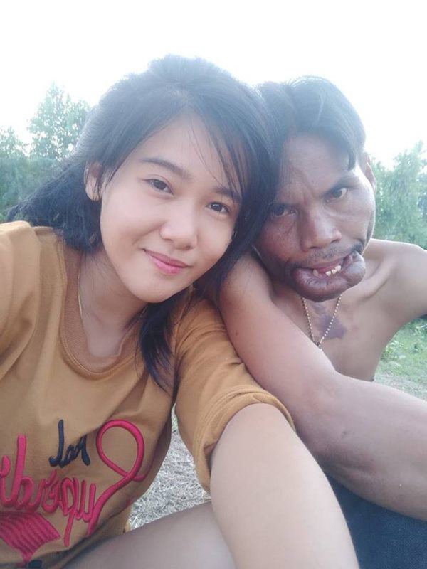 co gai xinh dep cuoi chong tho xay "khong khep duoc mieng", 2 nam sau doi thay doi khong ngo - 3
