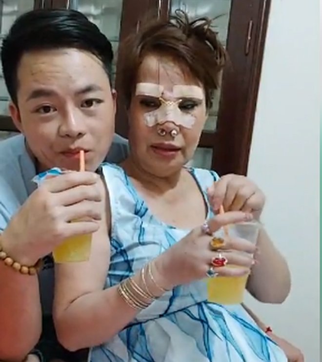 Tin tức 24h: Cô dâu Thu Sao tân trang nhan sắc ở tuổi 63, chi phí hàng chục triệu - 1