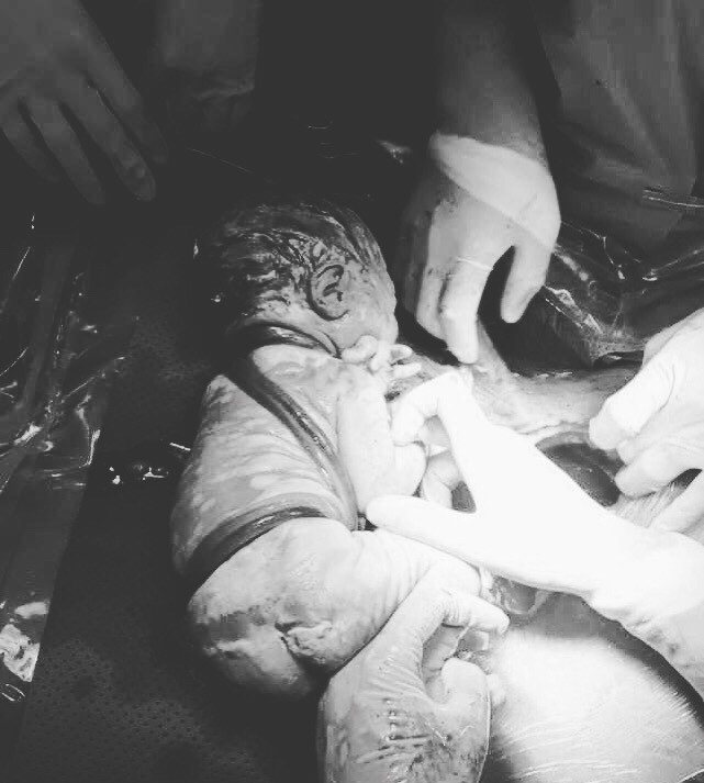 be trai chao doi voi 6 vong day ron quan co va bung, bac si thot len: qua dac biet! - 3