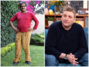 Sức khỏe - Những người có “cậu nhỏ” độc nhất thế giới: Người sau 45 năm mới có, người có gấp đôi