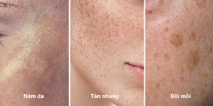 Suy giảm nội tiết tố nữ: Dấu hiệu và nguyên nhân do đâu - 7