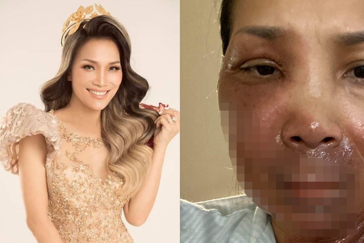 Sao Việt 24h: Dàn sao vui mừng khi Hồng Ngọc đăng ảnh dung mạo hiện tại sau vụ bỏng - 2