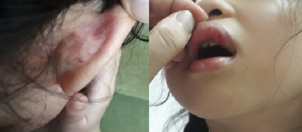 Cô giáo bị tố đánh HS lớp 2 giập môi, tụ máu: “Tôi còn lấy bông để HS thấm máu” - 1