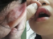 Tin tức - Cô giáo bị tố đánh HS lớp 2 giập môi, tụ máu: “Tôi còn lấy bông để HS thấm máu”