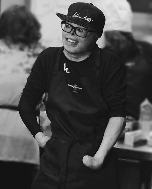 Cậu bé từng bị bỏng 95% cơ thể, trải qua 87 cuộc phẫu thuật đau đớn giờ ra sao? - 8