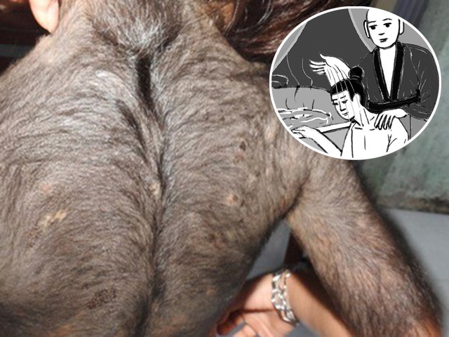 Căn bệnh bí ẩn khiến vua Lý Thần Tông hóa hổ, lông mọc toàn thân và cách chữa kỳ lạ