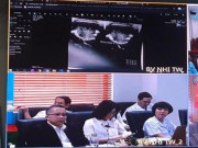 Sức khỏe - Khám chữa bệnh từ xa, phẫu thuật cứu sống bệnh nhi 23 ngày tuổi mắc bệnh tim nặng