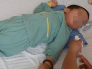 Sức khỏe - Bé 21 tháng tuổi bại não chỉ sau một cốc trà sữa trân châu