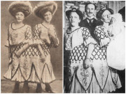 Sức khỏe - Cặp chị em song sinh dính liền đầu tiên trong lịch sử sinh con, gây thị phi vì quan hệ