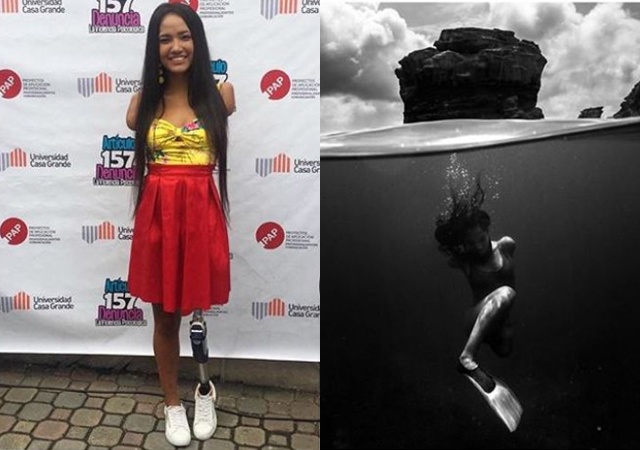 Cô gái xinh đẹp bị điện giật mất 3 chi, sống nhờ một chân duy nhất giờ ra sao? - 3