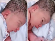 Bà bầu - Mẹ đẻ thường, con chào đời bị bẹp đầu, ai nhìn cũng thương