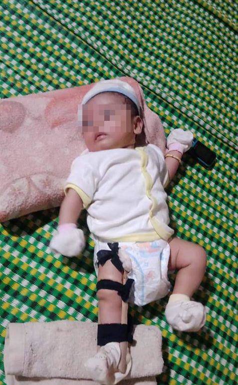 Lộ sự thật gây sốc vụ cha bị tố bạo hành, đánh gãy chân con 2 tháng tuổi - 1