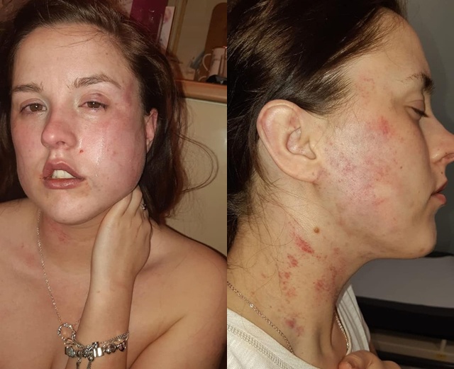 Làm phù dâu trong đám cưới chị gái, cô gái trẻ nhận kết cục vô cùng đau đớn - 2