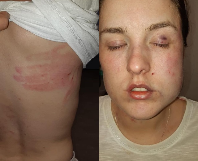 Làm phù dâu trong đám cưới chị gái, cô gái trẻ nhận kết cục vô cùng đau đớn - 3